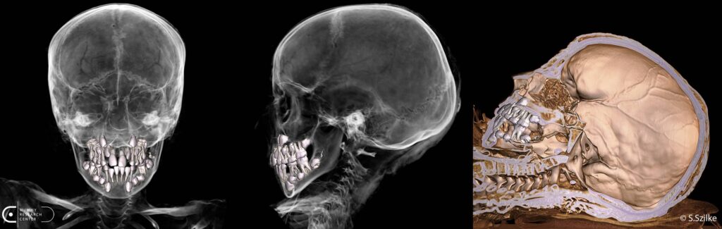 AI Scans 2,000-Year-Old Egyptian Child Mummy, Reveals Hidden Amulets and Preserved Organ
