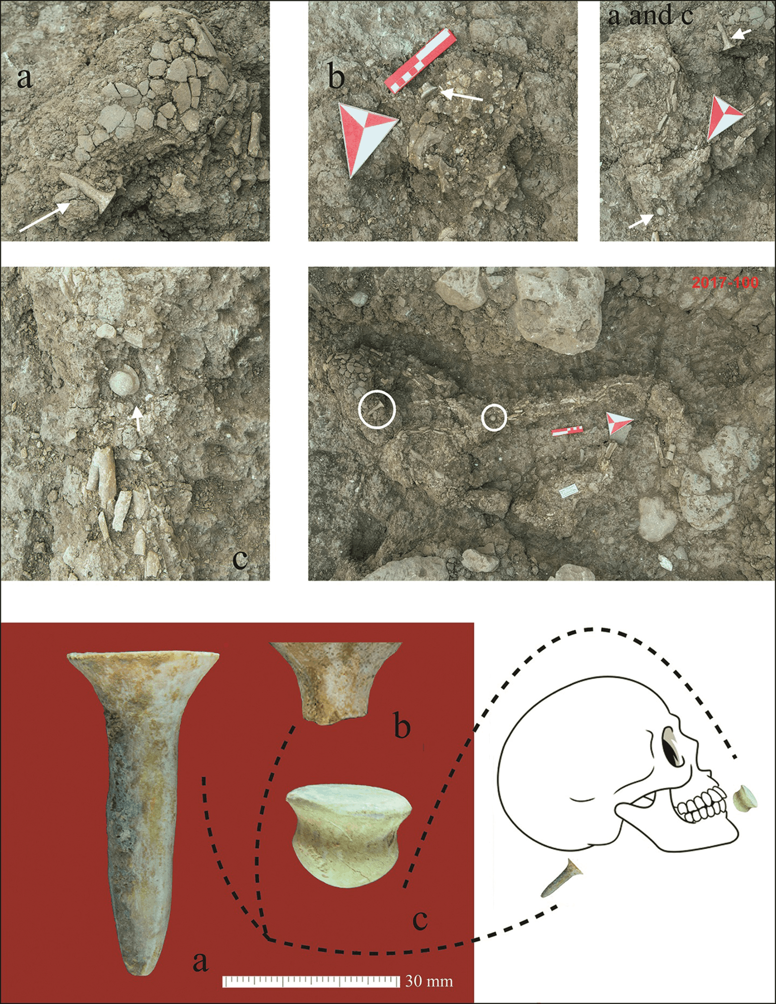 11,000-Year-Old Piercing Evidence at Boncuklu Tarla Reveals How ...