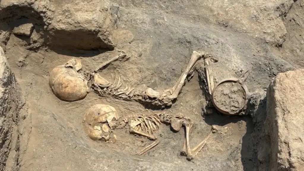 A 4,000-Year-Old Child’s Skull in Uzbekistan Reveals a Risky Bronze Age Surgery