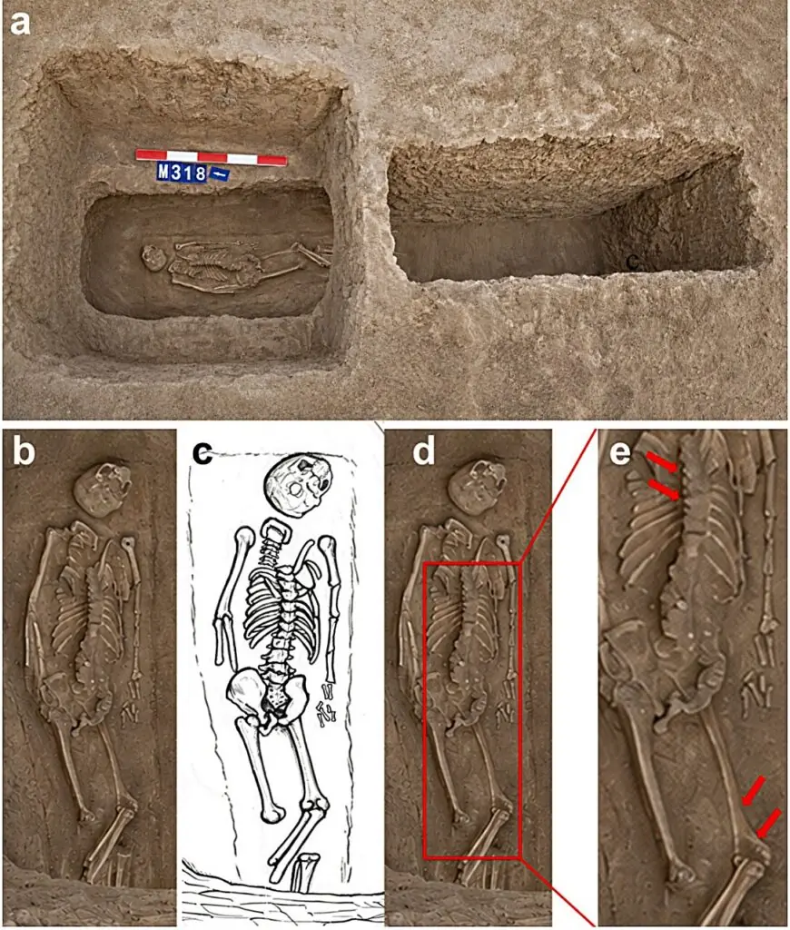 Grave M318 and the face-down burial of a medieval woman at Sanzhiyuan Cemetery in China.