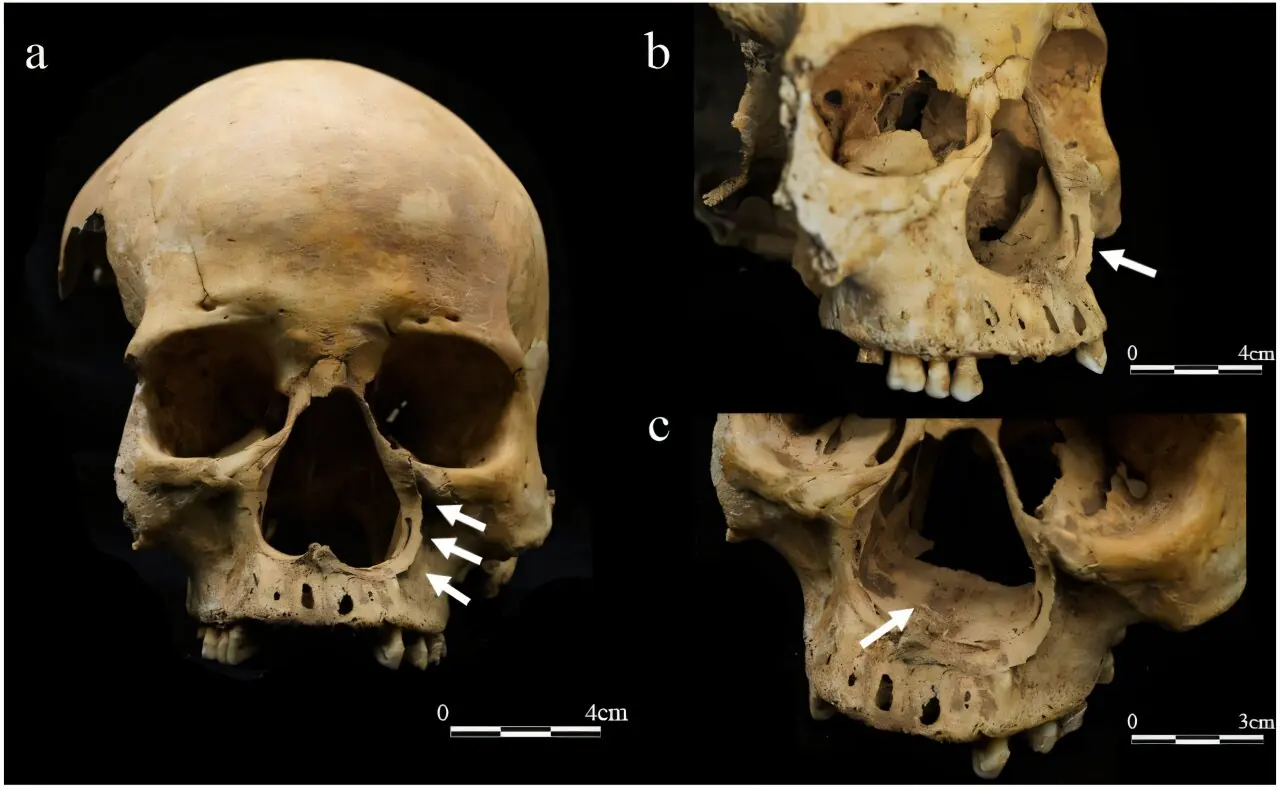 A Woman Buried Face Down in Medieval China May Reveal Evidence of a Brutal Punishment