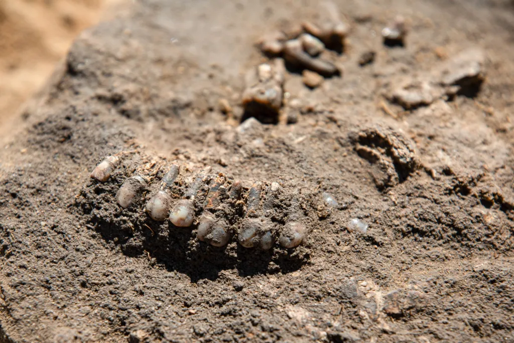 Preserved teeth from an additional human skull found in the prehistoric grave