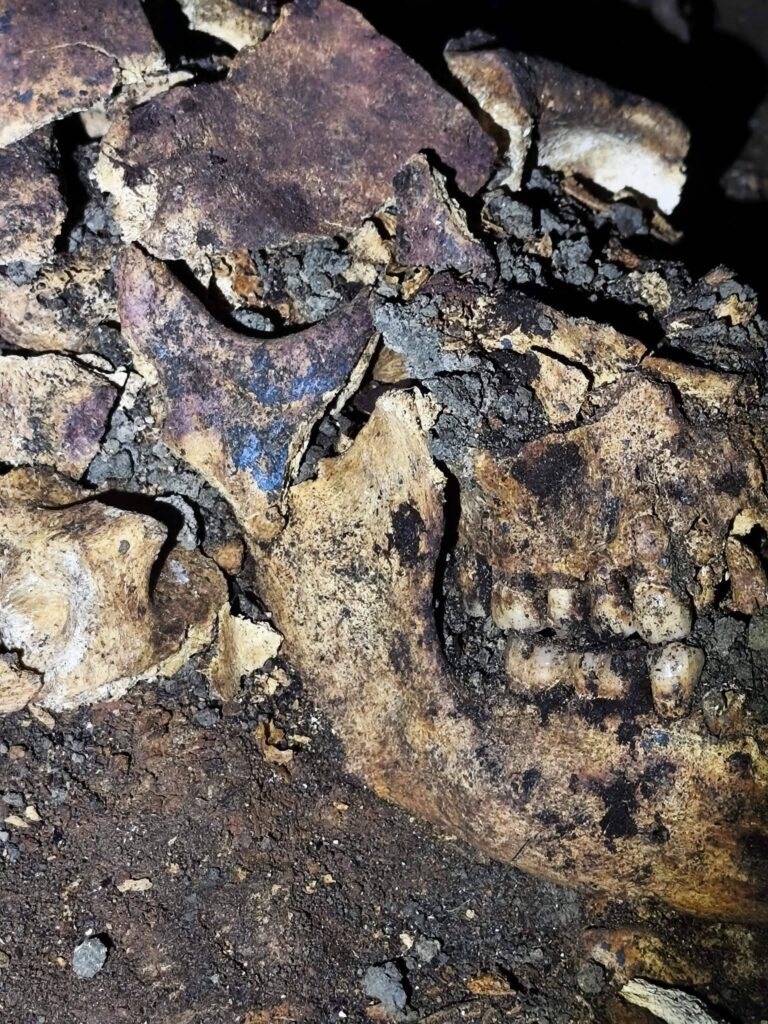 Blue-colored traces on the skull of the 5,000-year-old Plachi Dol skeleton in Bulgaria
