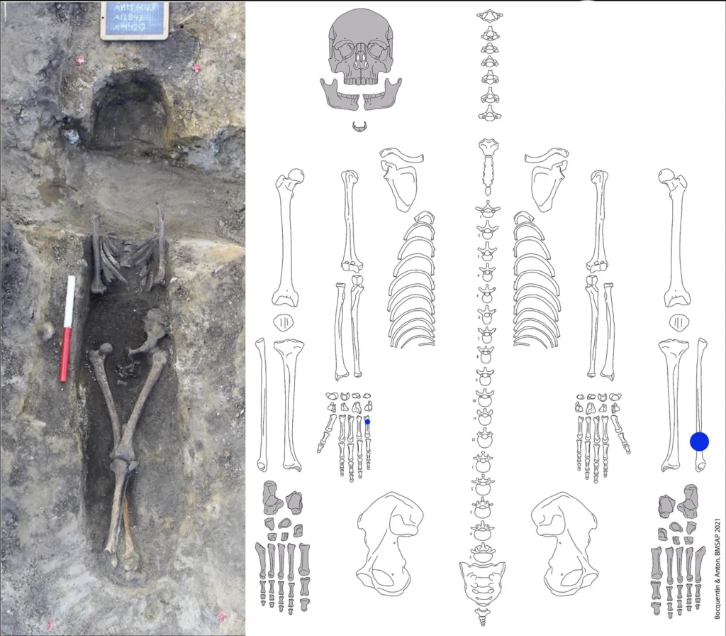 A 2,500-Year-Old Child’s Skull Beneath a House Floor Reveals Violence in Ancient Scandinavia