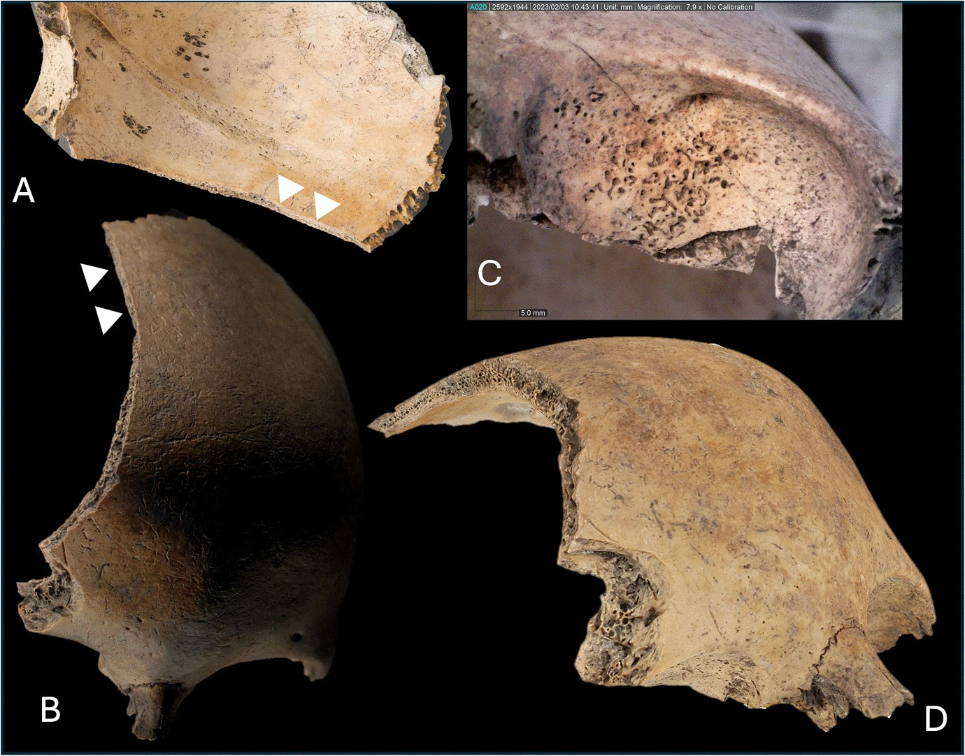 A 2,500-Year-Old Child’s Skull Beneath a House Floor Reveals Violence in Ancient Scandinavia