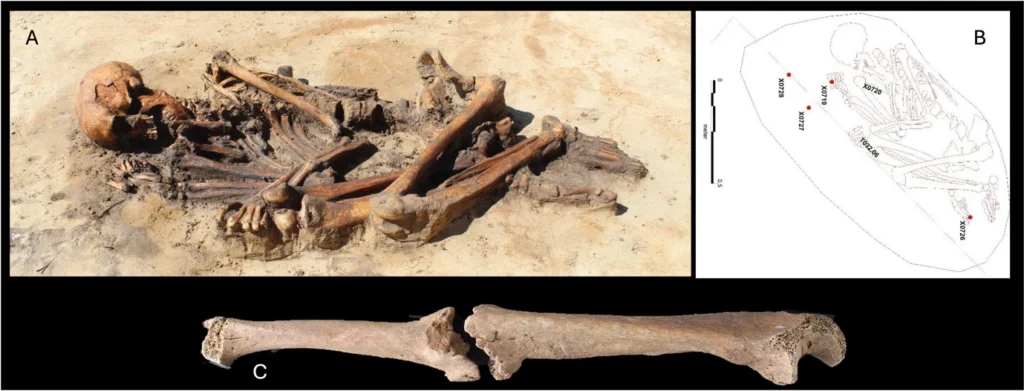 Adult male skeleton from Iron Age Denmark with a possible defensive fracture of the left forearm.